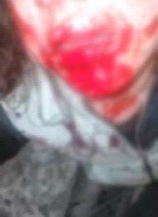 Недетская жестокость. В Биробиджане полиция проводит проверку по факту избиения 27-летней женщины двумя несовершеннолетними девицами 2008 и 2010 г.р. Инцидент, снятый на видео, произошел 5 ноября после словесного конфликта