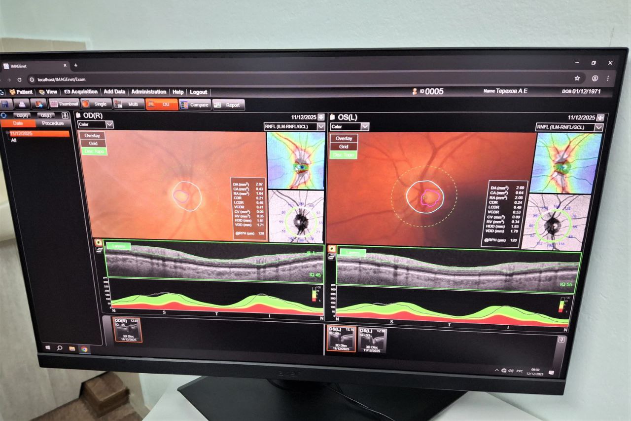 В Валдгеймской больнице учатся делать лазерную коррекцию зрения на высокотехнологичном оборудовании В Валдгеймской больнице учатся делать лазерную коррекцию зрения на высокотехнологичном оборудовании