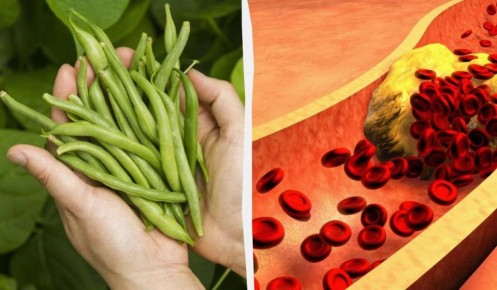 Зеленая фасоль: секрет здоровья для тех, кто борется с высоким холестерином